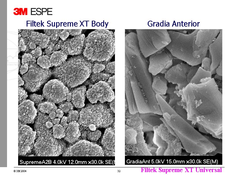 Filtek Supreme XT Body Gradia Anterior Filtek Supreme XT Body Gradia Anterior